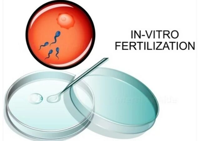 In vitro fertilization IVF