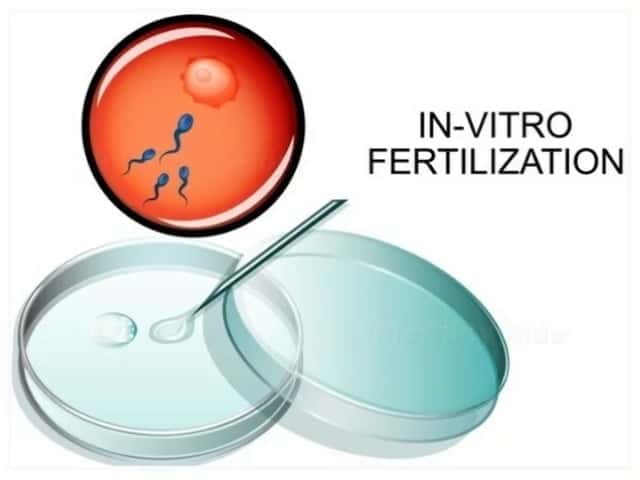 In vitro fertilization IVF