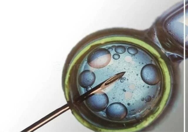 Intra cytoplasmic sperm injection - ICSI